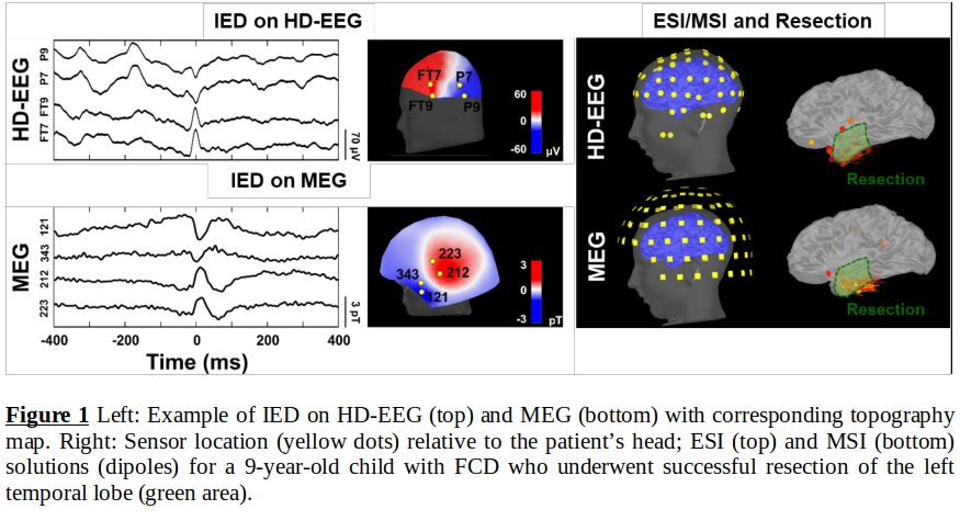 Pre-Surgical-Ability-of-Magnetic-and-Electric-Source-Imaging-to ...