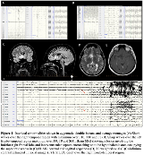 NNHFHMUU-1072605-1-IMG(1)