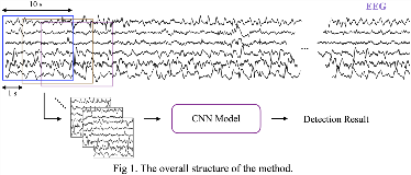 Diagnosis-Support-for-West-Syndrome-EEG-by-Explainable-Machine-Learning