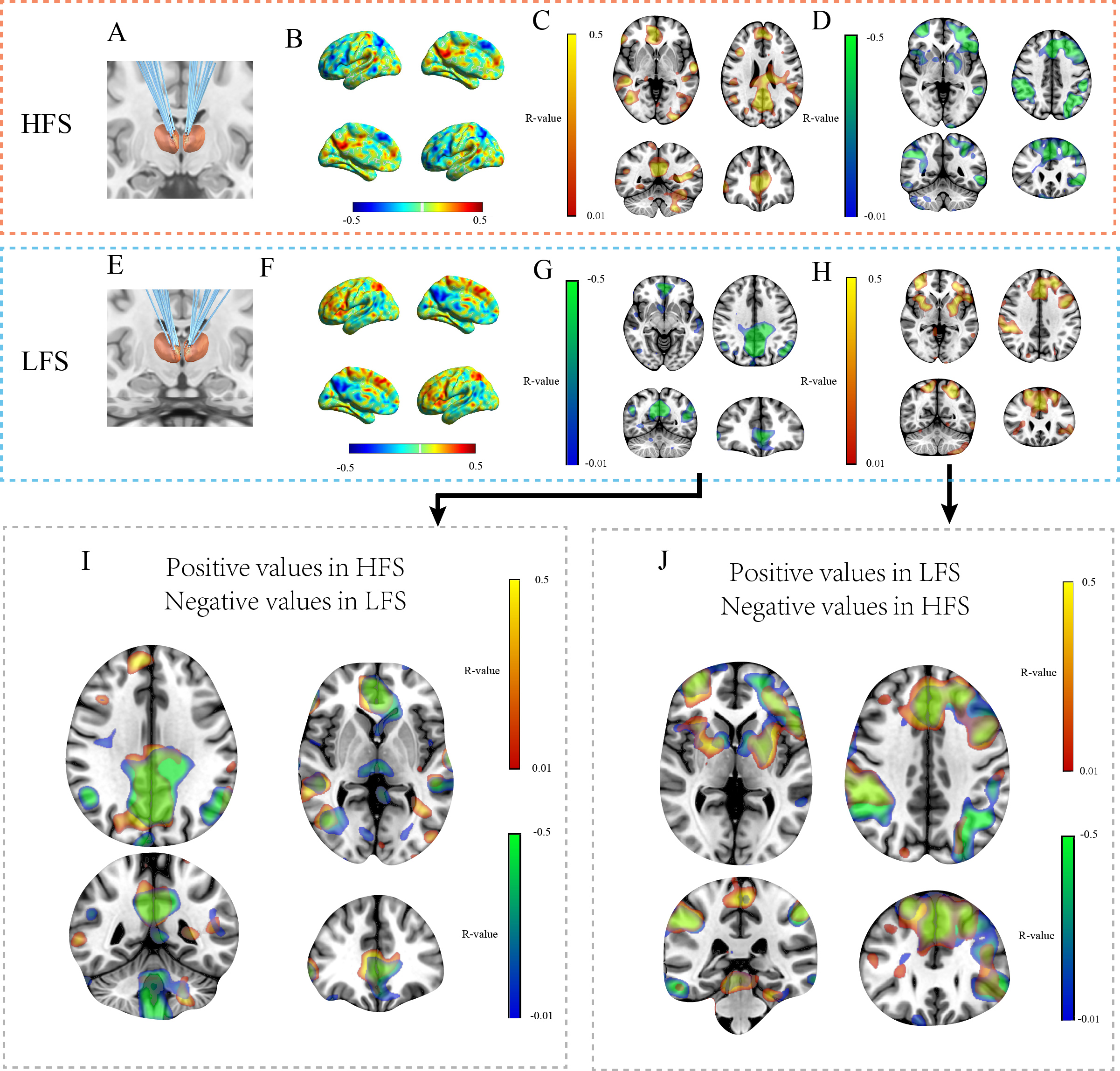 reversed effect of high versus lowfrequency deep brain stimulation on